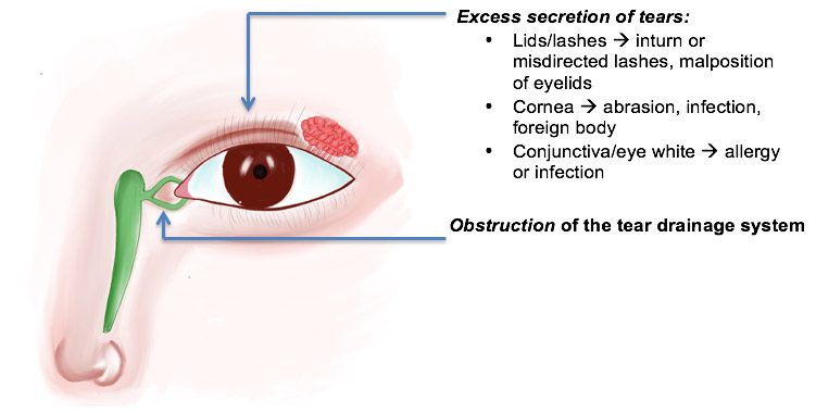 Tear vs. Tear - Usage, Difference & Meaning